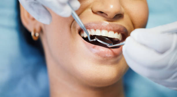 Best Emergency Tooth Extraction in Mount Carmel, OH